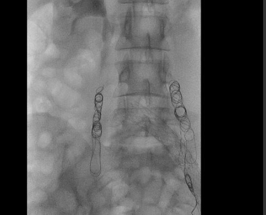 Weer een diagnose en hoe deze behandeld&nbsp;wordt